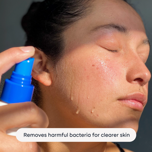 Magic Molecule - Hypochlorous Acid Spray