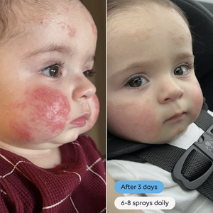 Magic Molecule - Hypochlorous Acid Spray