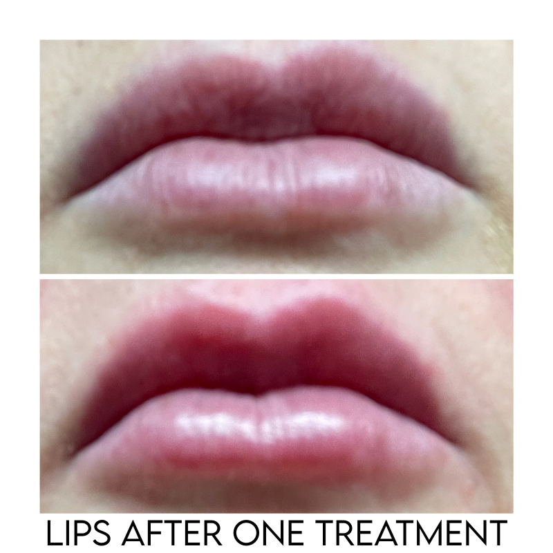 The Lip Ritual Kit 💋