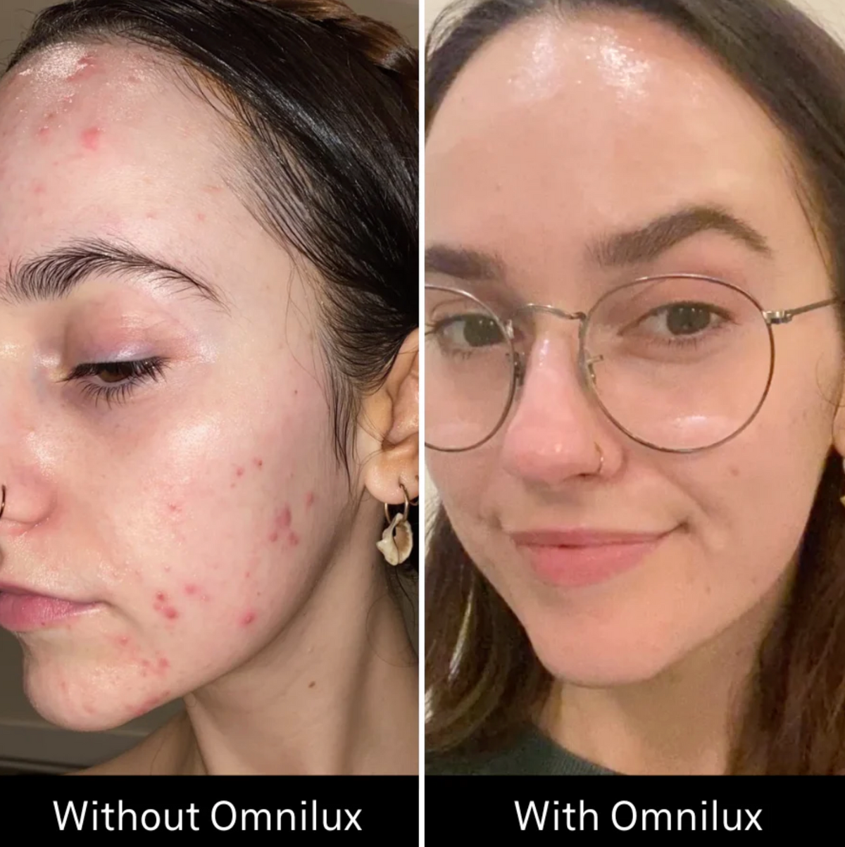 Omnilux Clear LED Mask