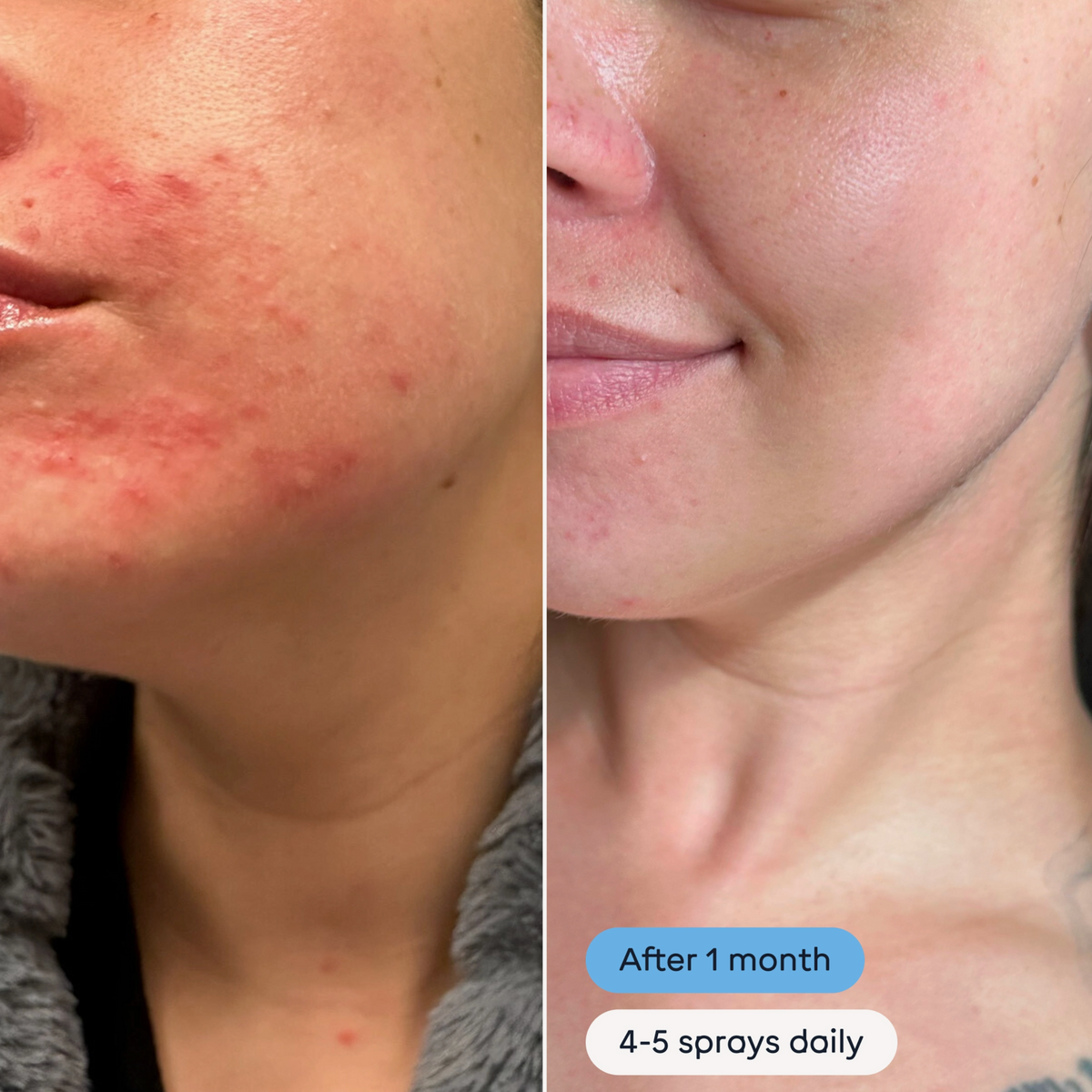 Magic Molecule - Hypochlorous Acid Spray