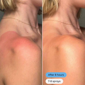 Magic Molecule - Hypochlorous Acid Spray